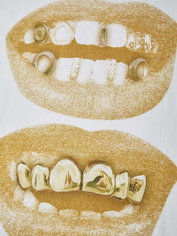 BOUNCE BACK© Retro Gold Lips Grills Print Tee